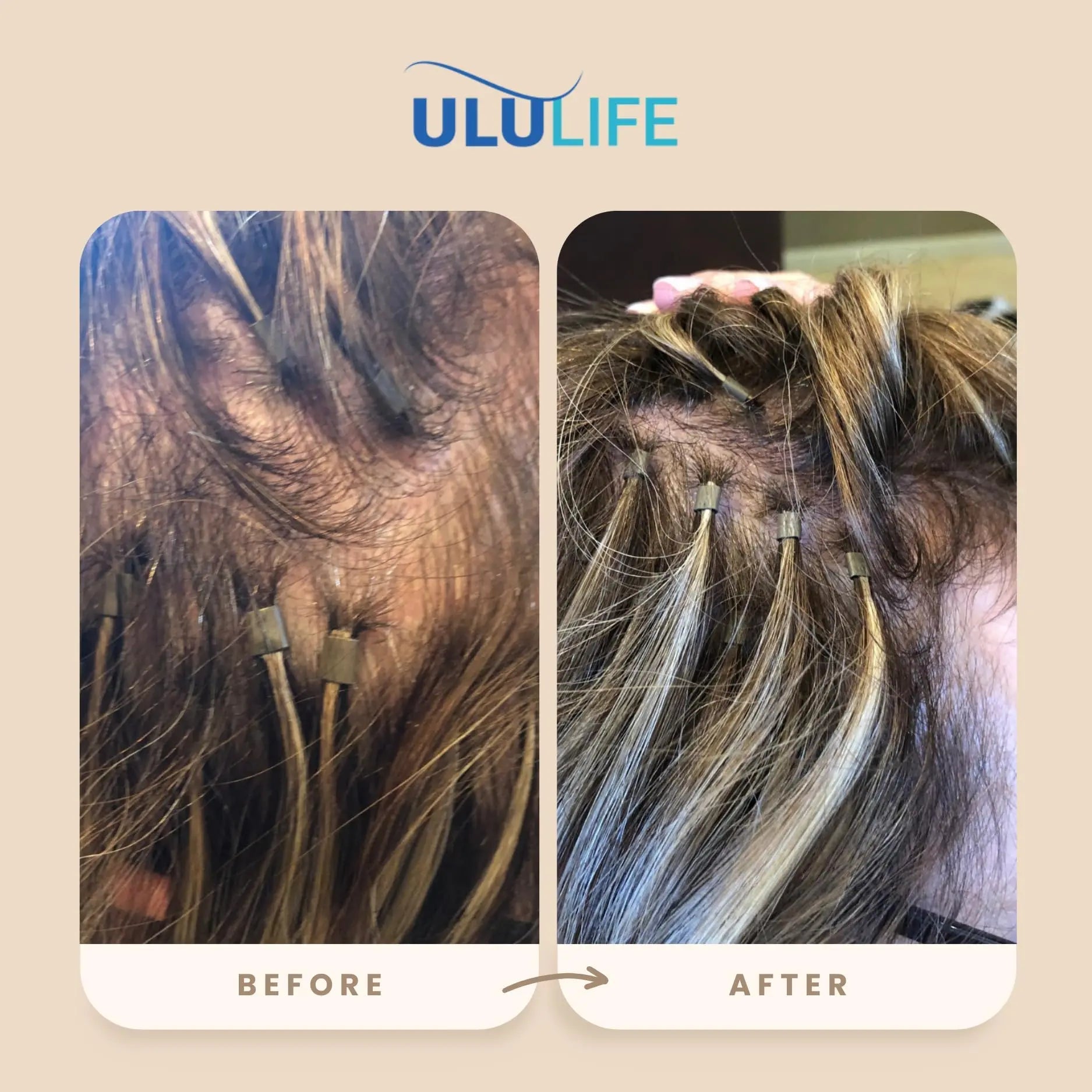 ULULIFE Complete Multivitamin for Men & Women: All-Natural & Cruelty Free with Biotin, Collagen, Keratin, & More - Promotes Hair Growth & Thickness ULULIFEAu supplements
