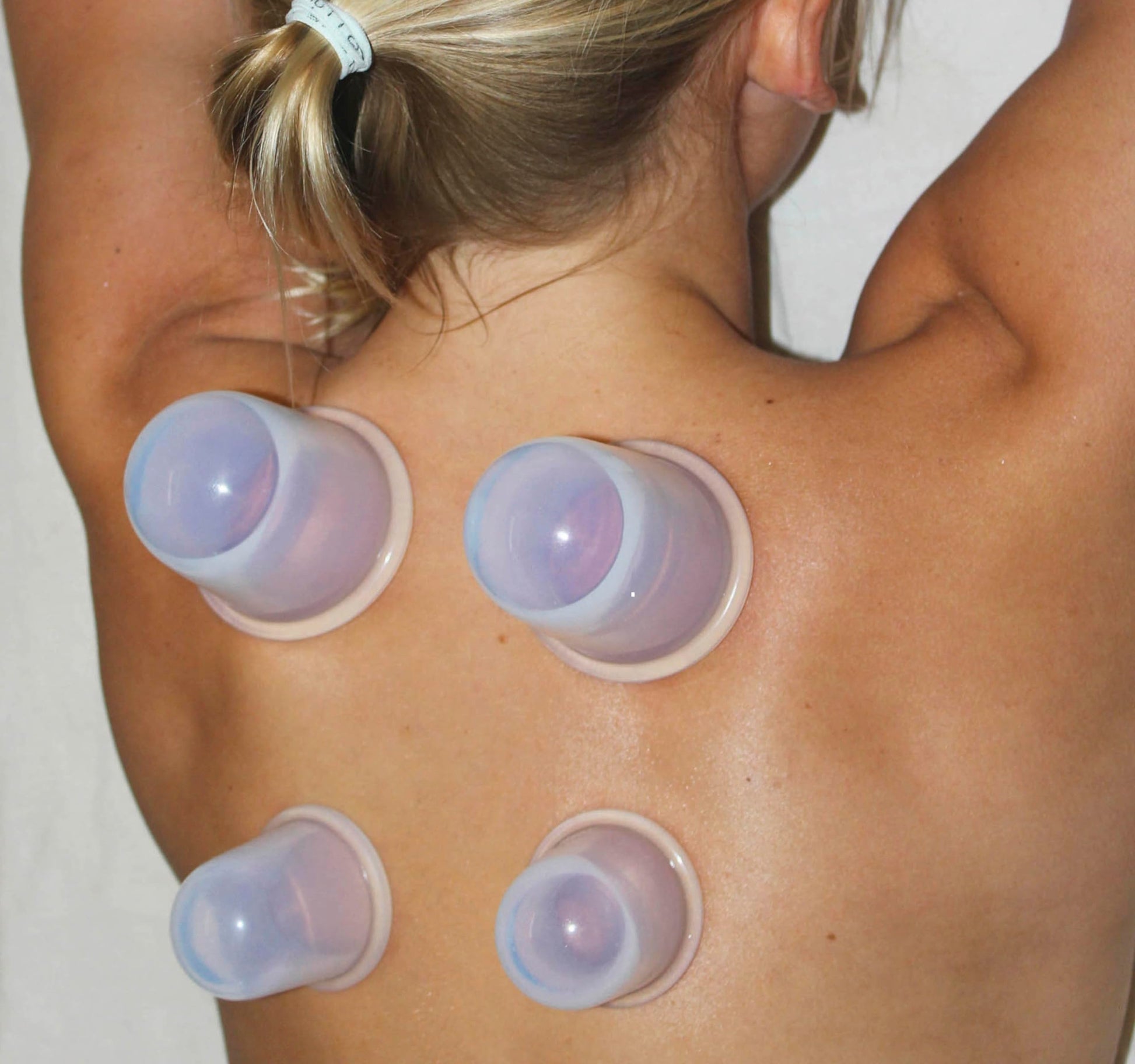 Cupping Kit for Massage Therapy - by DoSensePro, Cupping Set of 6 Professional Silicone Cups DoSenseProAu supplements