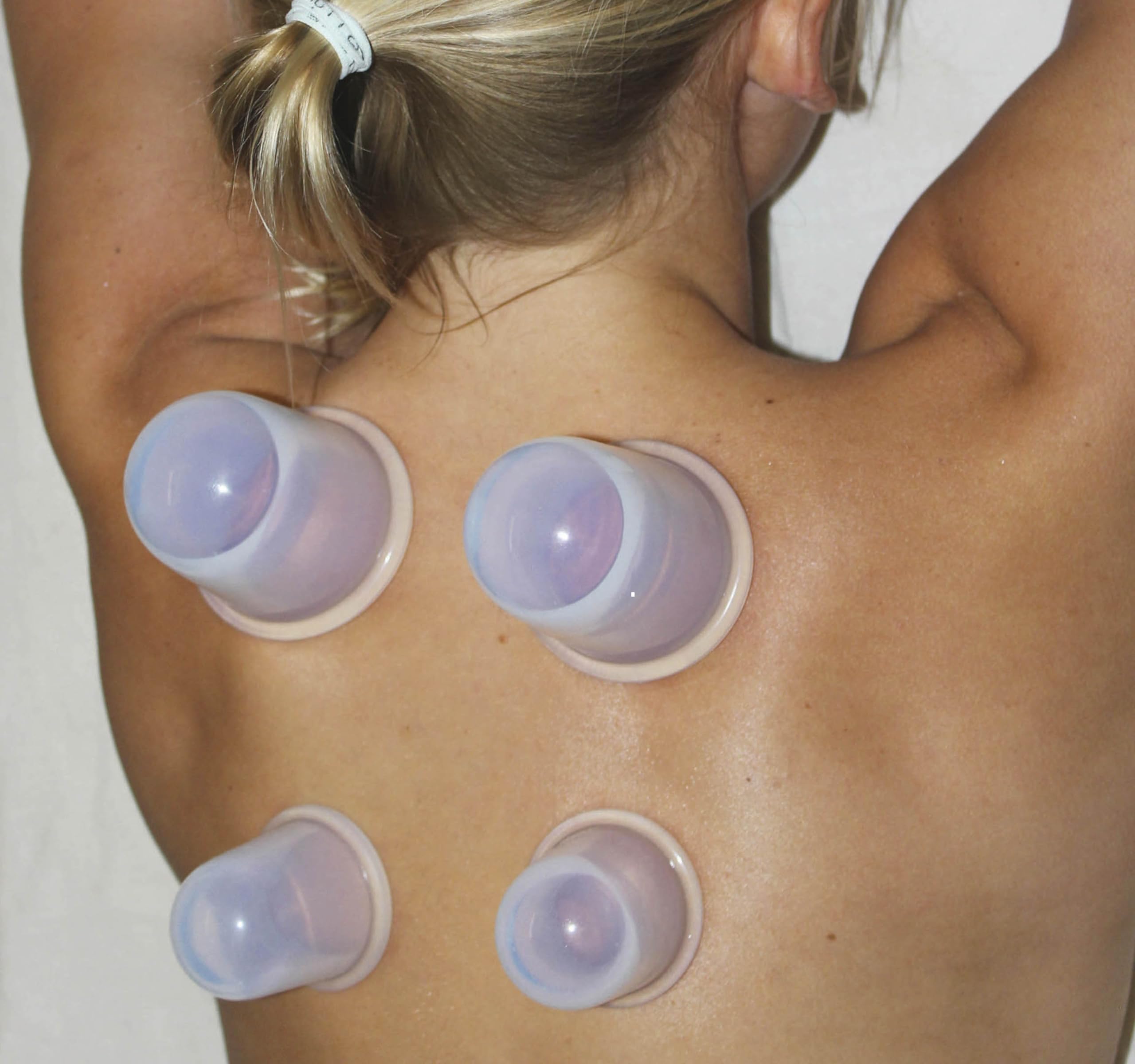 Cupping Kit for Massage Therapy - by DoSensePro, Cupping Set of 6 Professional Silicone Cups DoSenseProAu supplements