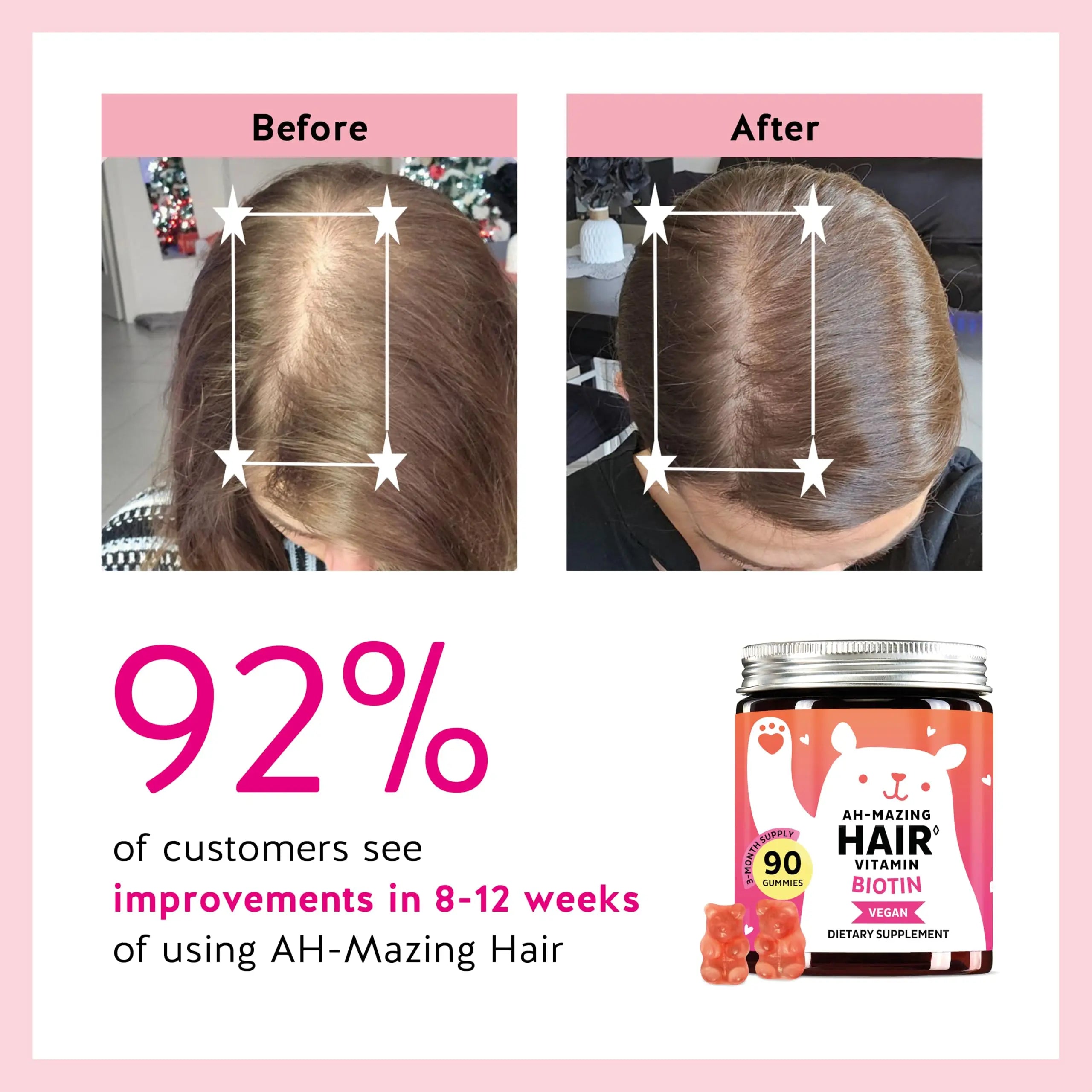 Biotin Gummies for Hair, Skin & Nails. 5,000 mcg High Potency Vegan Vitamins for Faster Hair Growth, Stronger Nails & Healthy Skin. with Vitamins C & E, 90 Gummies Bears with BenefitsAu supplements