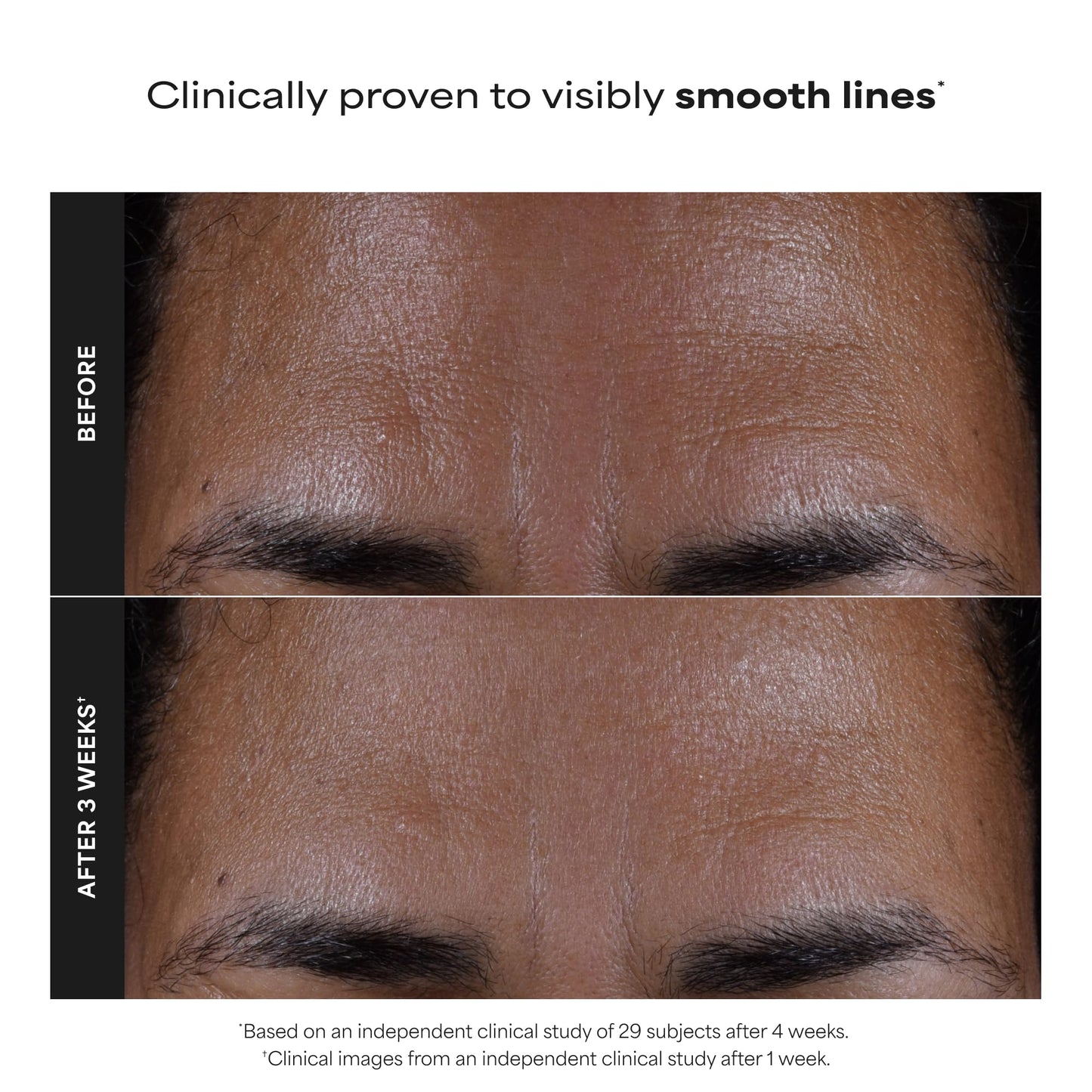 Paulas Choice--SKIN PERFECTING 2% BHA Liquid Salicylic Acid Exfoliant--Facial Exfoliant Paula's ChoiceUS supplements