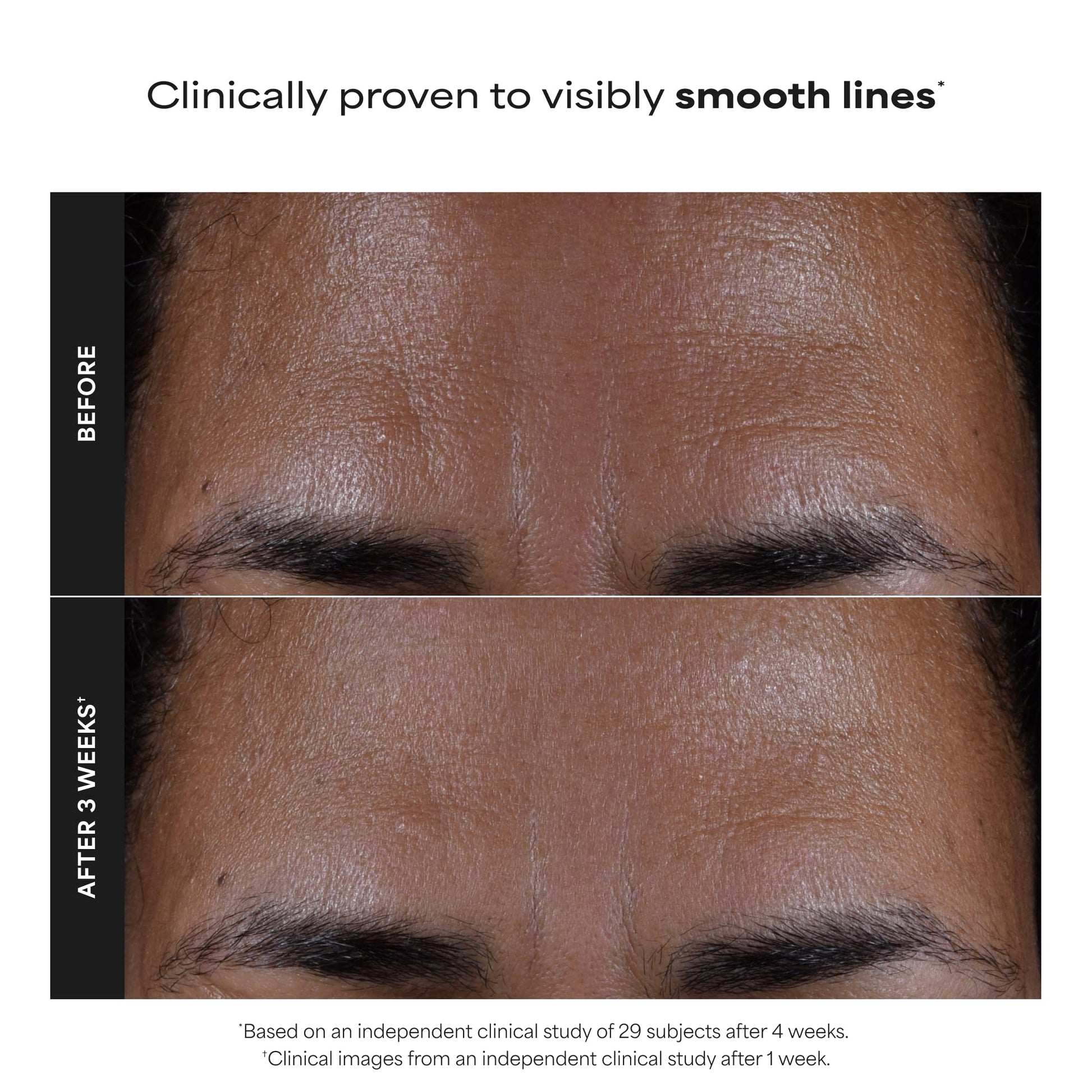 Paulas Choice--SKIN PERFECTING 2% BHA Liquid Salicylic Acid Exfoliant--Facial Exfoliant Paula's ChoiceUS supplements