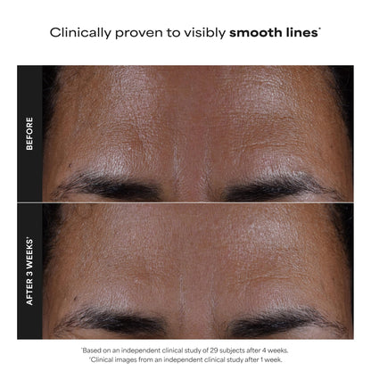 Paulas Choice--SKIN PERFECTING 2% BHA Liquid Salicylic Acid Exfoliant--Facial Exfoliant Paula's ChoiceUS supplements