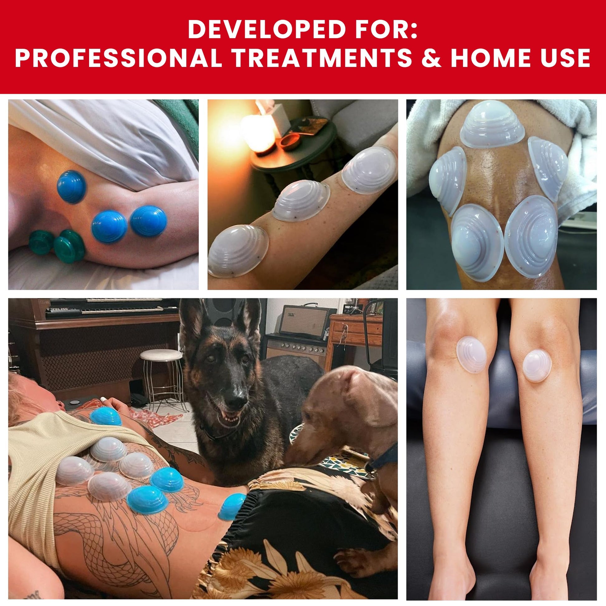 Lure Essentials Cupping Therapy Set 10 Professional Silicone Cupping Cups for Muscle Knots, Joints, Muscles, Arms and Feet Lure EssentialsAu supplements