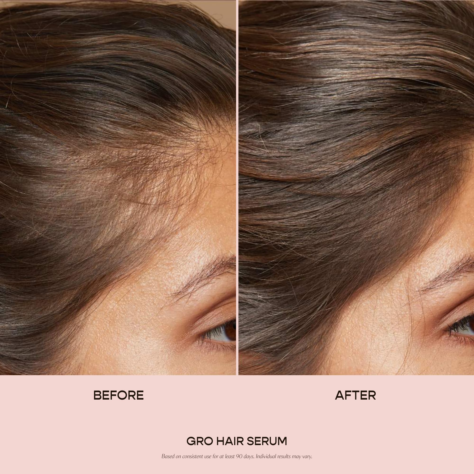 VEGAMOUR GRO Hair Serum for Hair Thinning, Thicker Fuller Looking Hair, Non Oily Tonic for Healthier Scalp, 30 day Supply 1.0 fl oz, 1 pack VEGAMOURAu supplements