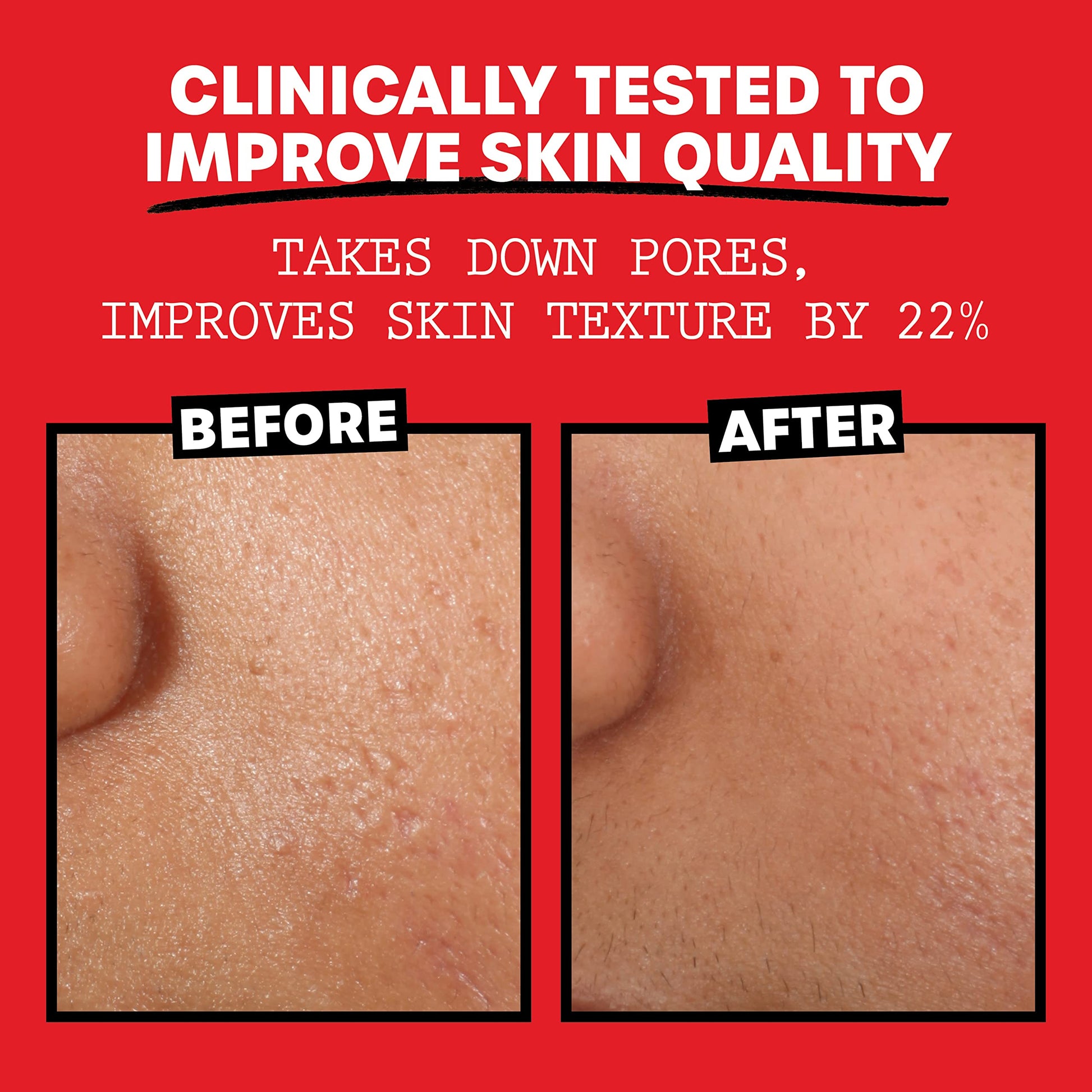 Thayers Alcohol-Free, Hydrating Rose Petal Witch Hazel Facial Toner 12 oz + 3oz THAYERSAu supplements