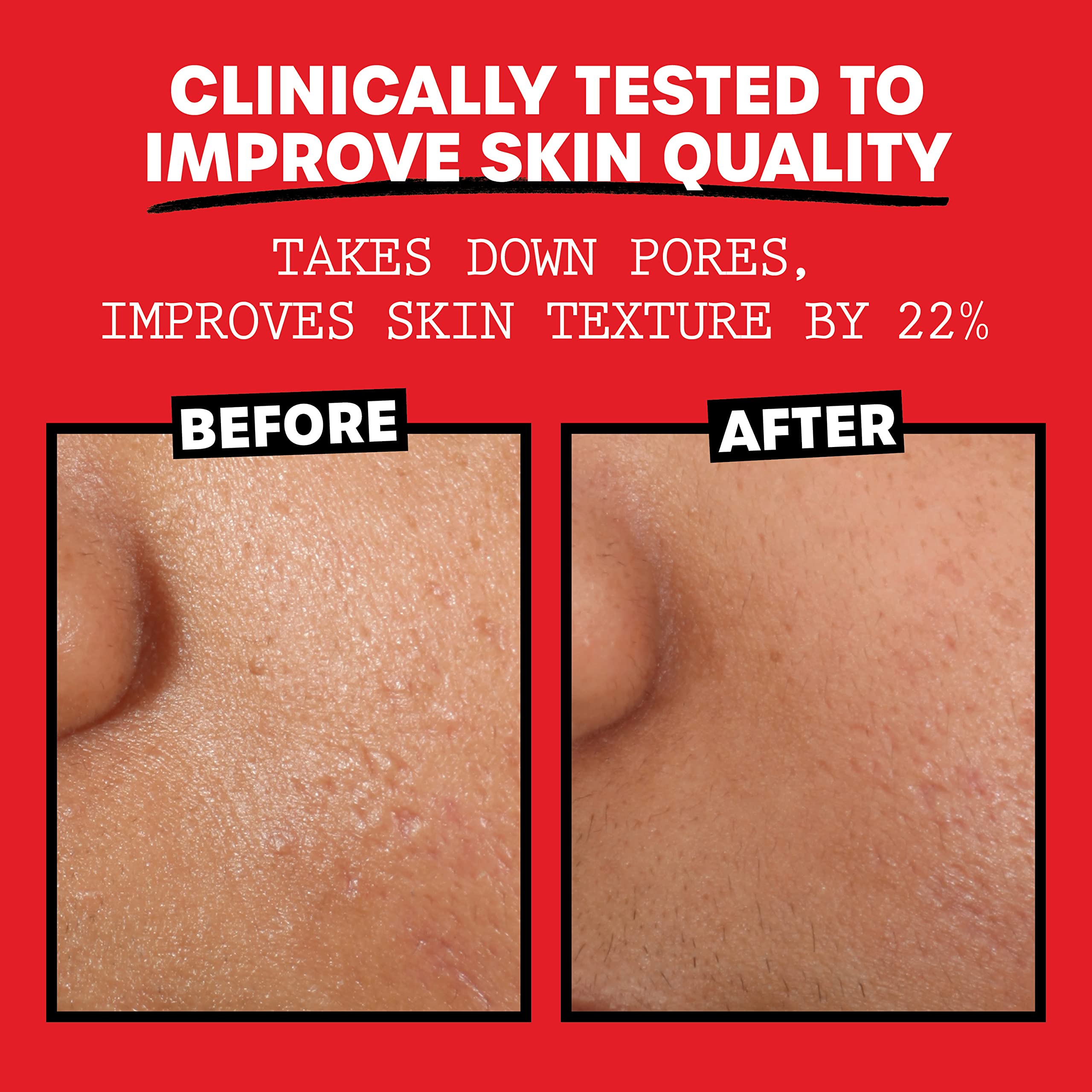 Thayers Alcohol-Free, Hydrating Rose Petal Witch Hazel Facial Toner 12 oz + 3oz THAYERSAu supplements
