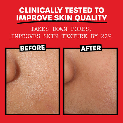 Thayers Alcohol-Free, Hydrating Rose Petal Witch Hazel Facial Toner 12 oz + 3oz THAYERSUS supplements
