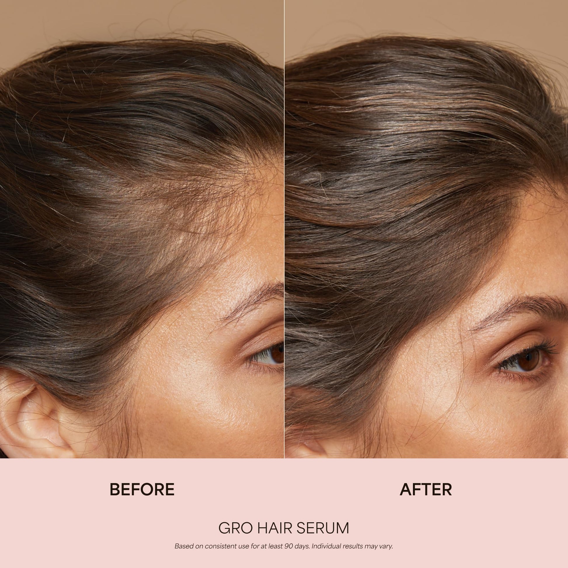 VEGAMOUR GRO Healthy Hair Starter Kit | Full Size GRO Serum for Thinning & Shedding plus Travel Size Shampoo and Conditioner with Vegan Keratin to Support Thicker, Fuller Looking Locks | $92 Value VEGAMOURAu supplements