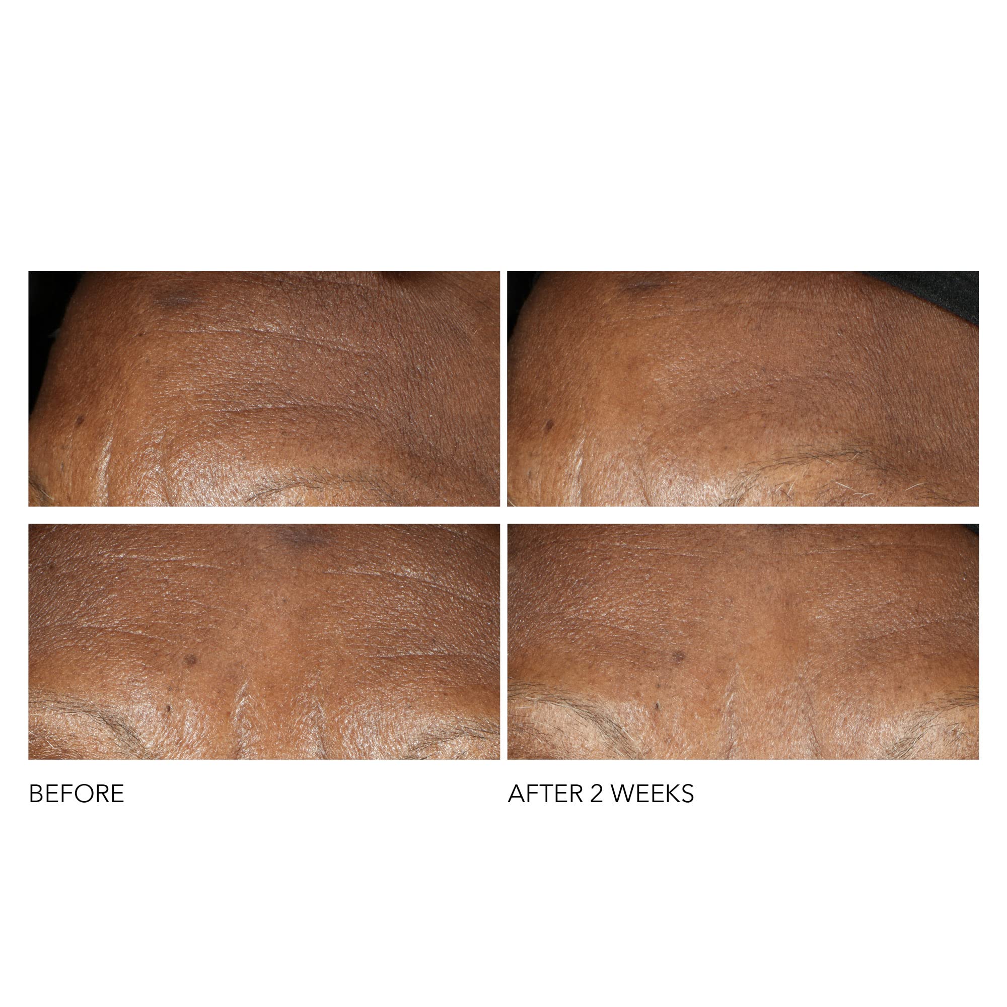 Dr Dennis Gross Advanced Retinol + Ferulic Intense Wrinkle Cream | Intensely Hydrating to Visibly Transform Skin and Repair the Moisture Barrier | 2 oz Dr Dennis GrossAu supplements