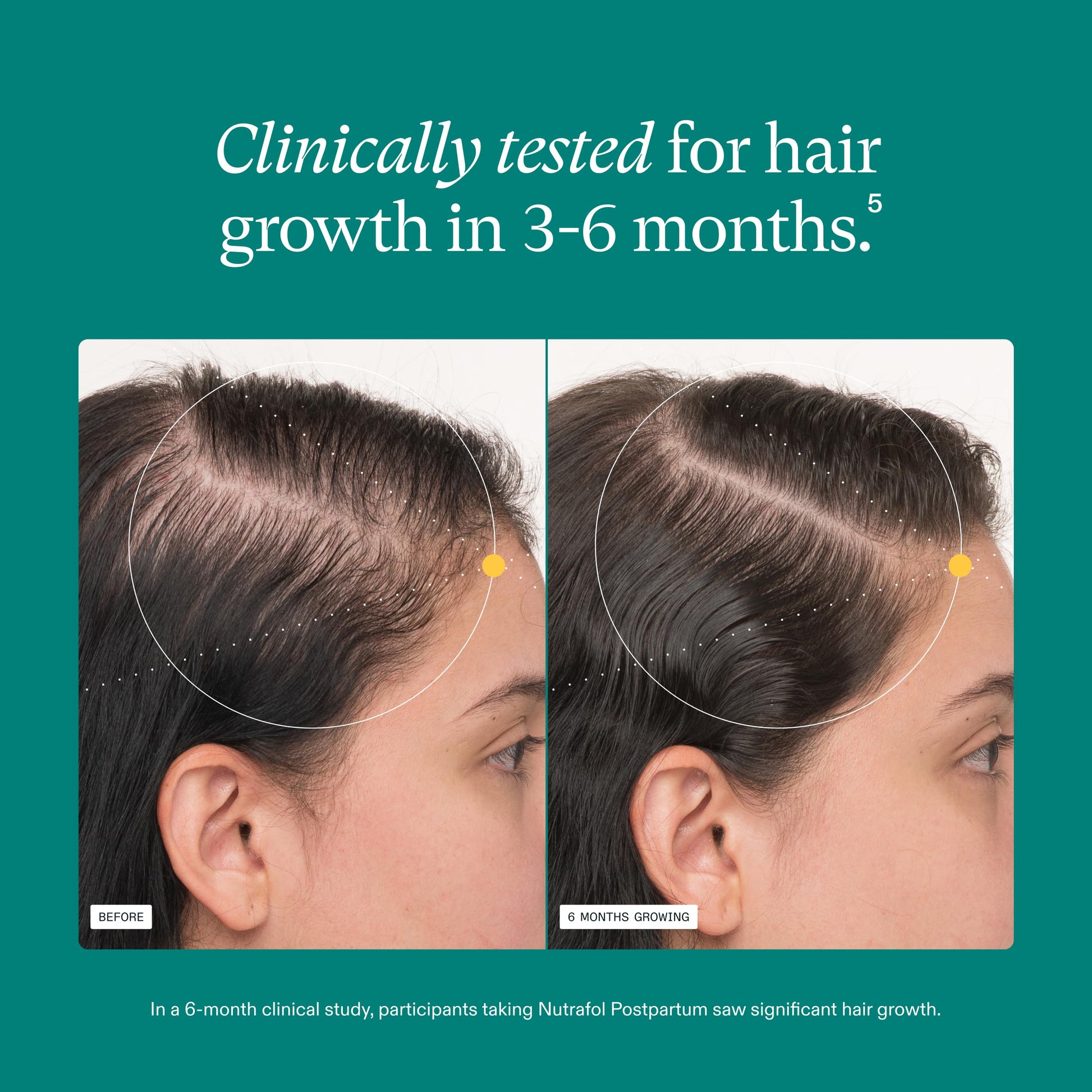Nutrafol Postpartum Hair Growth Supplements, Clinically Tested for Visibly Thicker Hair and Less Shedding, Breastfeeding-friendly - 1 Month Supply NutrafolUS supplements