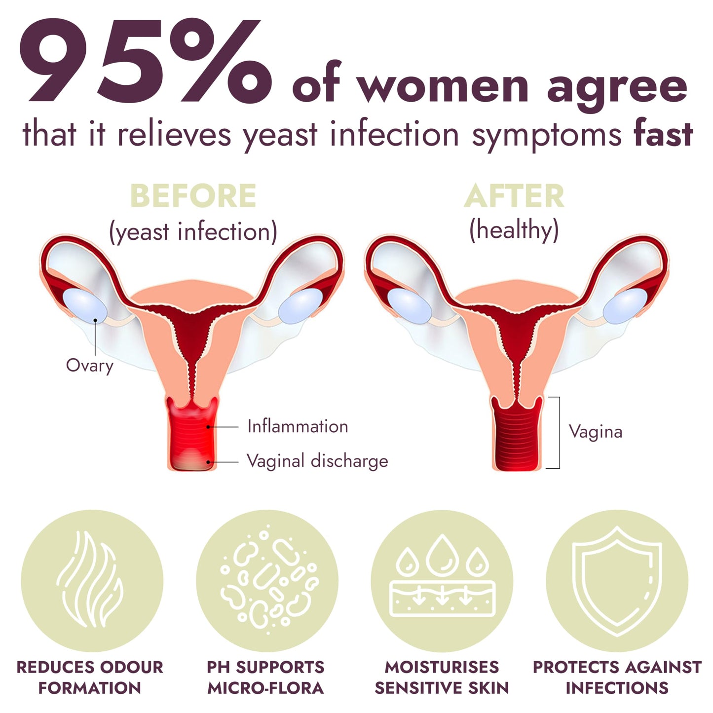 Yeast Infection Treatment for Women | Boric Acid Suppositories For Women | Helps Relieve Itching & Irritation | Vaginal Aid for Inflammation, Dryness & Watery Discharge | 12 Vaginal Suppositories Terramed Just Think ComfortUS supplements