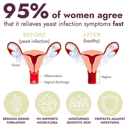 Yeast Infection Treatment for Women | Boric Acid Suppositories For Women | Helps Relieve Itching & Irritation | Vaginal Aid for Inflammation, Dryness & Watery Discharge | 12 Vaginal Suppositories Terramed Just Think ComfortUS supplements