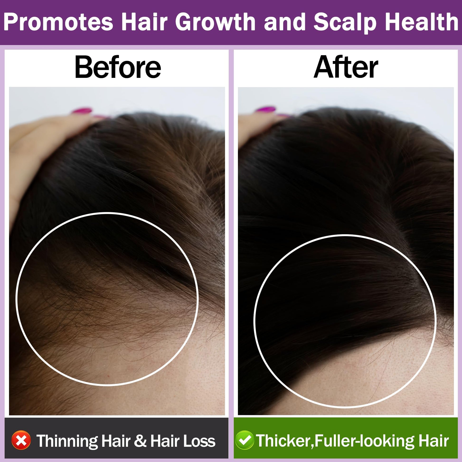 Rosemary Oil for Hair Growth,100% Pure Undiluted Light-Weight Non-Greasy Rosemary Essential Oil GIFBEAAu supplements