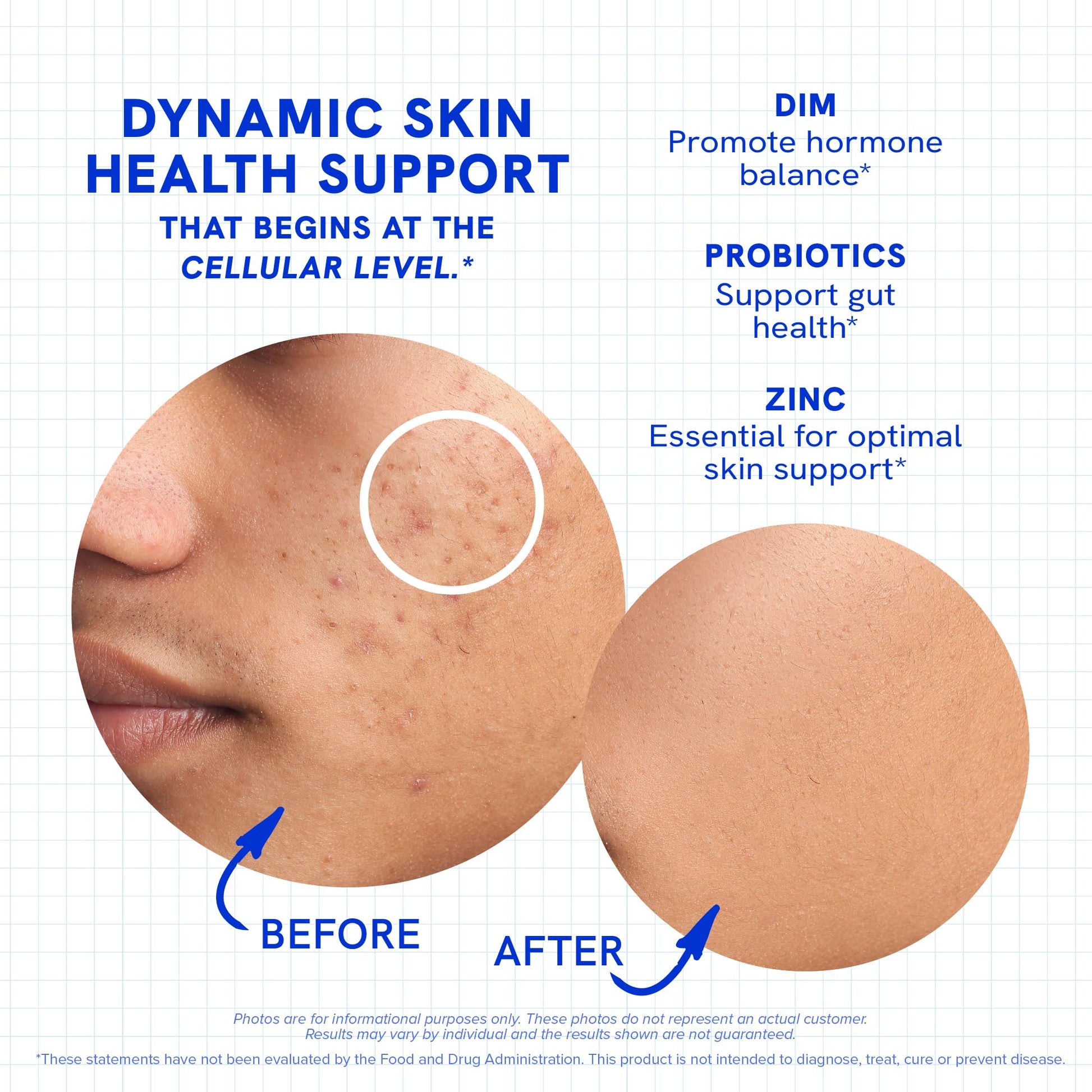 Clear Skin Supplement with Zinc, DIM & Probiotics | 3-in-1 Balance, Glow & Health Skin Support | Triple Action Hyaluronic Acid, Niaciminide & Vitamins for Hormone, Complexion & Gut Support | 180 Ct SMNutritionAu supplements