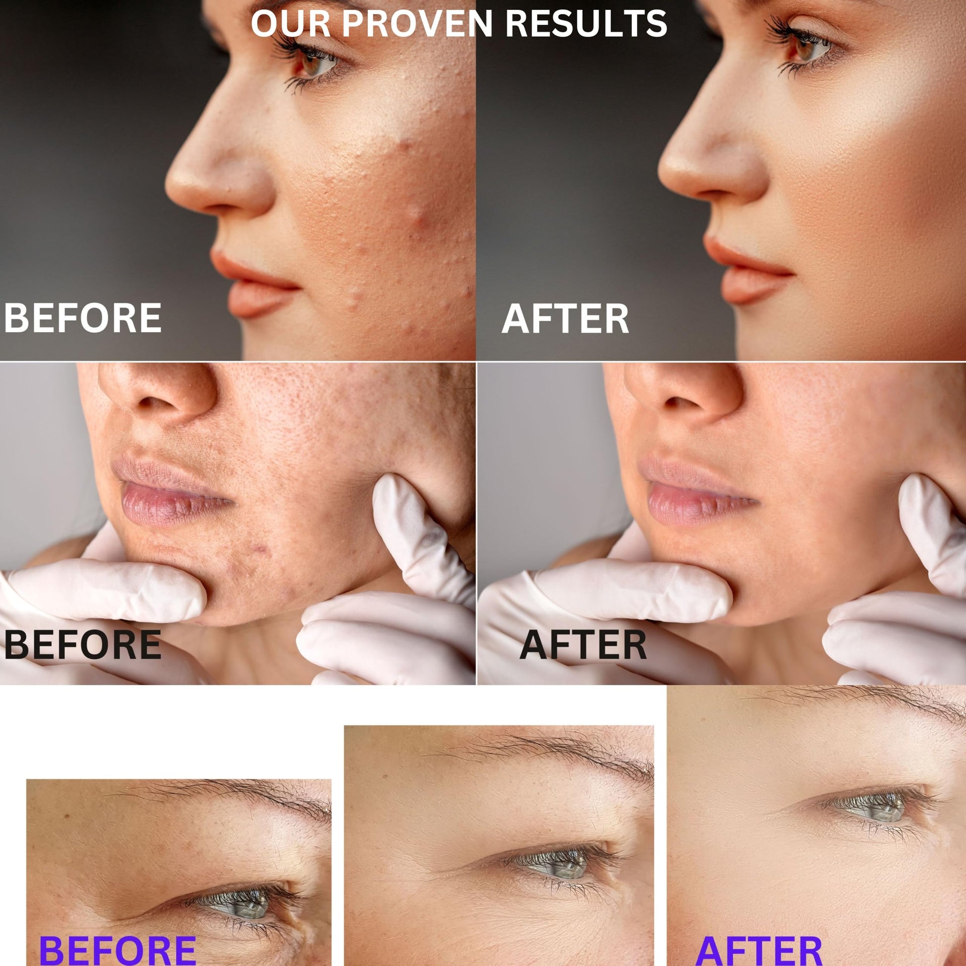 SkinVitalize C E ferulux Vitamin C Serum - 30ml: Advanced Formula for Fighting with Wrinkles Msupps.comAu supplements