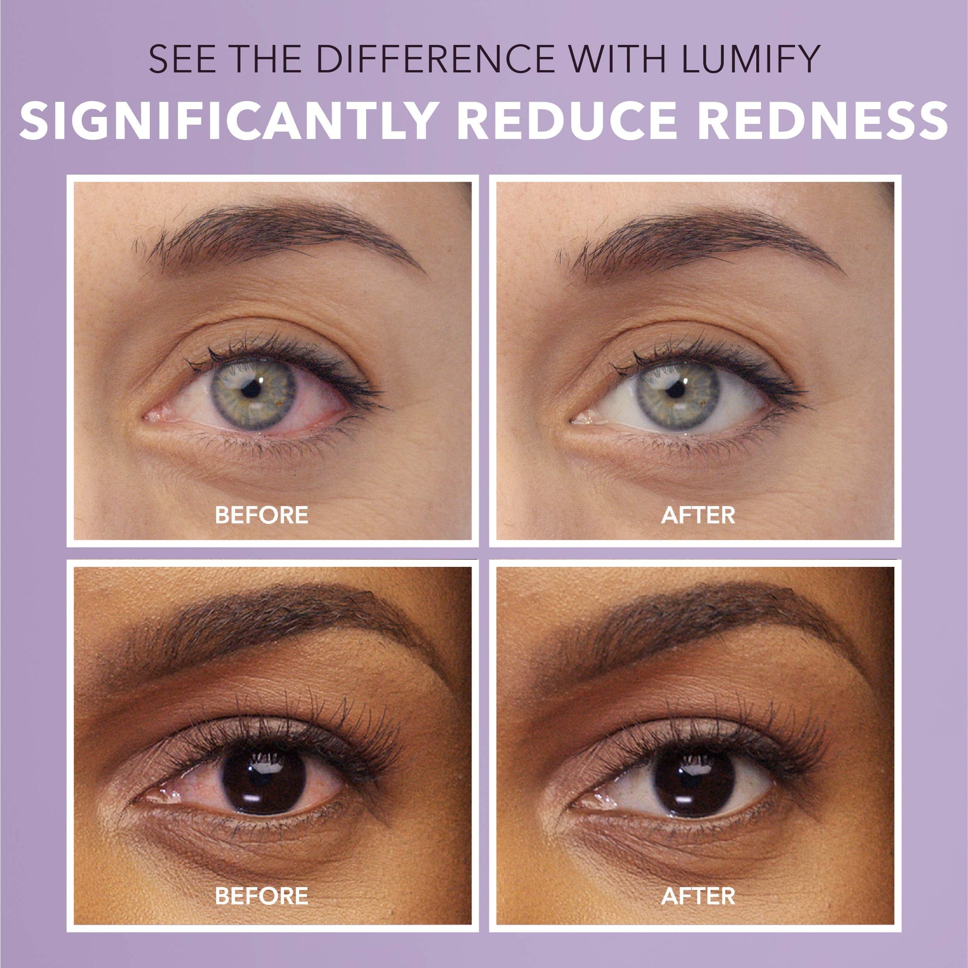 LUMIFY Eye Drops for Red Eyes, Redness Reliever for Brighter Looking Eyes, Works in 1 Minute & Lasts Up to 8 Hours, Eye Drops, 0.25 Fl Oz (7.5mL) LUMIFYAu supplements